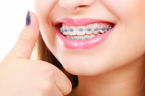 Orthodontist specialists in ahmedabad