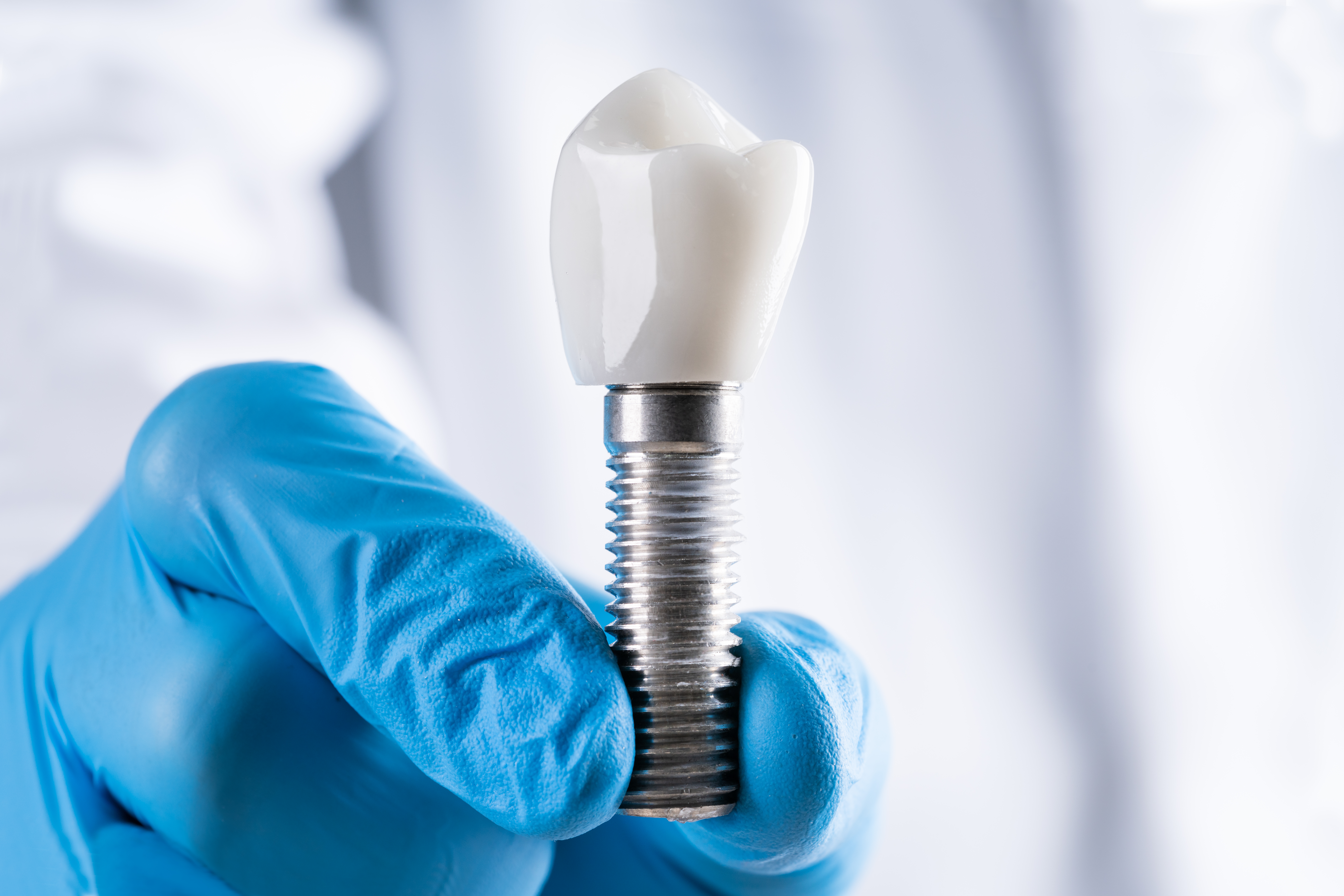 dental implant costs in Ahmedabad
